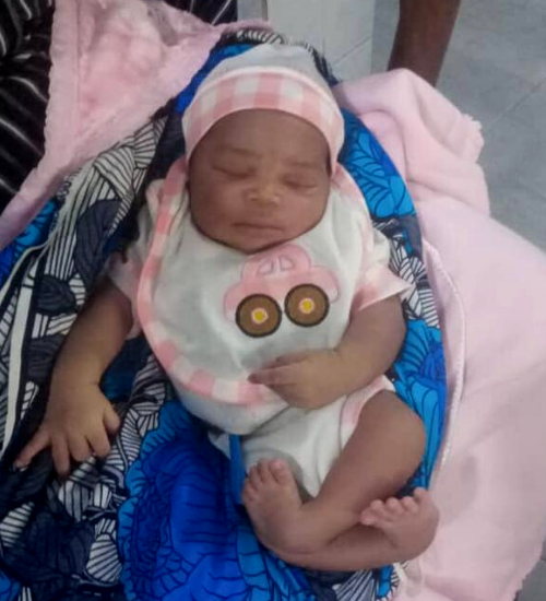 Salamato - Benin - Before Baby born with clubfoot in Benin before starting Ponseti treatment