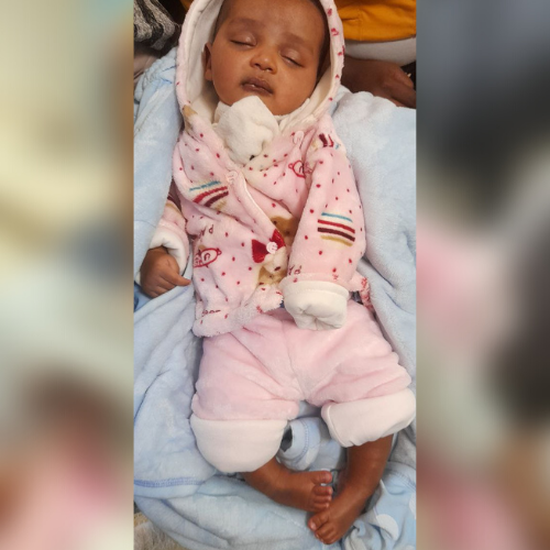 Baby Kusa - Ethiopia - before