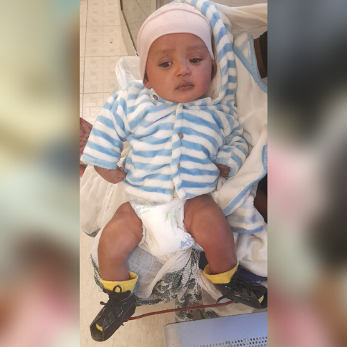 Baby Kusa - Ethiopia - braces